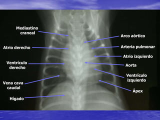 Mediastino
craneal
Arco aórtico
Arteria pulmonar
Atrio izquierdo
Ventrículo
izquierdo
Aorta
Ápex
Atrio derecho
Ventrículo
derecho
Vena cava
caudal
Hígado
 