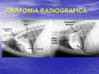 ANATOMIA RADIOGRAFICA
 