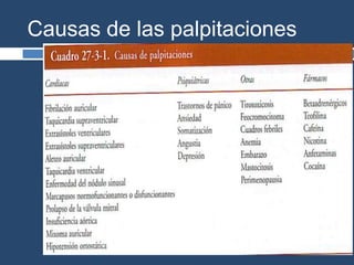 Causas de las palpitaciones
 