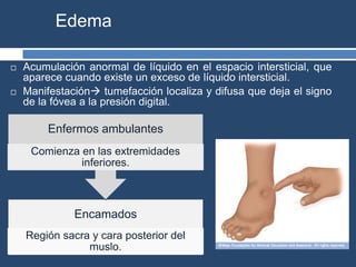 Edema
 Acumulación anormal de líquido en el espacio intersticial, que
aparece cuando existe un exceso de líquido intersticial.
 Manifestación tumefacción localiza y difusa que deja el signo
de la fóvea a la presión digital.
Encamados
Región sacra y cara posterior del
muslo.
Enfermos ambulantes
Comienza en las extremidades
inferiores.
 