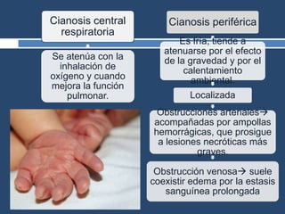 Cianosis central
respiratoria
Se atenúa con la
inhalación de
oxígeno y cuando
mejora la función
pulmonar.
Cianosis periférica
Es fría, tiende a
atenuarse por el efecto
de la gravedad y por el
calentamiento
ambiental.
Localizada
Obstrucciones arteriales
acompañadas por ampollas
hemorrágicas, que prosigue
a lesiones necróticas más
graves.
Obstrucción venosa suele
coexistir edema por la estasis
sanguínea prolongada
 