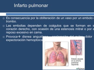 Infarto pulmonar
 Es consecuencia por la obliteración de un vaso por un embolo o
trombo.
 Las embolias dependen de coágulos que se forman en e
corazón derecho, con ocasión de una estenosis mitral o por e
reposo excesivo en cama.
 Provoca disnea angustiosa, aceleración del pulso, dolor y
expectoración hemoptoica.
 