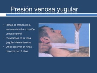 • Refleja la presión de la
aurícula derecha o presión
venosa central.
• Pulsaciones en la vena
yugular interna derecha
• Difícil observar en niños
menores de 12 años.
 