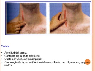 Evaluar:
• Amplitud del pulso.
• Contorno de la onda del pulso.
• Cualquier variación de amplitud.
• Cronología de la pulsación carotídea en relación con el primero y segudo
ruidos.
 