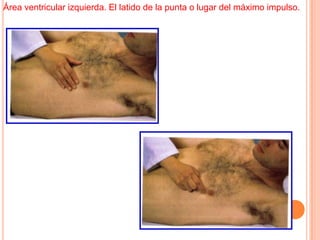 Área ventricular izquierda. El latido de la punta o lugar del máximo impulso.
 