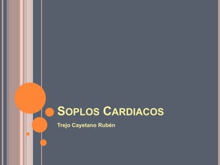 SOPLOS CARDIACOS
Trejo Cayetano Rubén
 