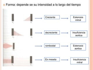  Forma: depende se su intensidad a lo largo del tiempo
Creciente
romboidal
En meseta
decreciente
Estenosis
mitral
Estenosis
aortica
Insuficiencia
mitral
Insuficiencia
aortica
 