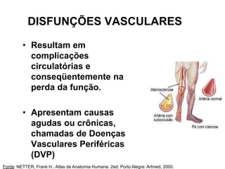DISFUNÇÕES VASCULARES
• Resultam em
complicações
circulatórias e
conseqüentemente na
perda da função.
• Apresentam causas
agudas ou crônicas,
chamadas de Doenças
Vasculares Periféricas
(DVP)
Fonte: NETTER, Frank H.. Atlas de Anatomia Humana. 2ed. Porto Alegre: Artmed, 2000.
 