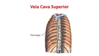 Veia Cava Superior
 
