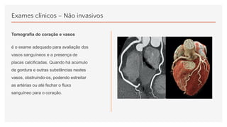 Exames clínicos – Não invasivos
Tomografia do coração e vasos
é o exame adequado para avaliação dos
vasos sanguíneos e a presença de
placas calcificadas. Quando há acúmulo
de gordura e outras substâncias nestes
vasos, obstruindo-os, podendo estreitar
as artérias ou até fechar o fluxo
sanguíneo para o coração.
 