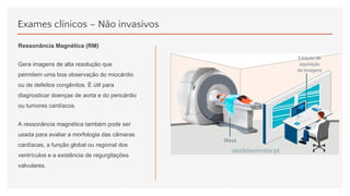 Exames clínicos – Não invasivos
Ressonância Magnética (RM)
Gera imagens de alta resolução que
permitem uma boa observação do miocárdio
ou de defeitos congênitos. É útil para
diagnosticar doenças de aorta e do pericárdio
ou tumores cardíacos.
A ressonância magnética também pode ser
usada para avaliar a morfologia das câmaras
cardíacas, a função global ou regional dos
ventrículos e a existência de regurgitações
valvulares.
 