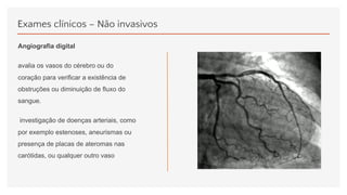 Exames clínicos – Não invasivos
Angiografia digital
avalia os vasos do cérebro ou do
coração para verificar a existência de
obstruções ou diminuição de fluxo do
sangue.
investigação de doenças arteriais, como
por exemplo estenoses, aneurismas ou
presença de placas de ateromas nas
carótidas, ou qualquer outro vaso
 