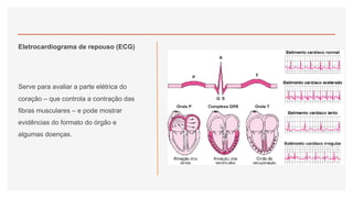 Eletrocardiograma de repouso (ECG)
Serve para avaliar a parte elétrica do
coração – que controla a contração das
fibras musculares – e pode mostrar
evidências do formato do órgão e
algumas doenças.
 