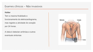Exames clínicos – Não invasivos
Holter
Tem a mesma finalidade e
funcionamento do eletrocardiograma,
mas registra a atividade do coração
por 24 horas.
A ideia é detectar arritmias e outros
eventuais sintomas
 