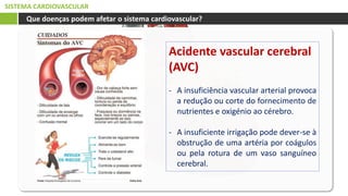 SISTEMA CARDIOVASCULAR
Que doenças podem afetar o sistema cardiovascular?
Acidente vascular cerebral
(AVC)
- A insuficiência vascular arterial provoca
a redução ou corte do fornecimento de
nutrientes e oxigénio ao cérebro.
- A insuficiente irrigação pode dever-se à
obstrução de uma artéria por coágulos
ou pela rotura de um vaso sanguíneo
cerebral.
 