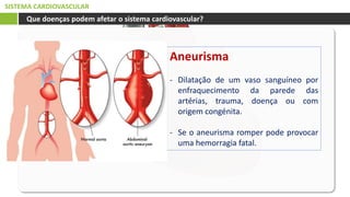 SISTEMA CARDIOVASCULAR
Que doenças podem afetar o sistema cardiovascular?
Aneurisma
- Dilatação de um vaso sanguíneo por
enfraquecimento da parede das
artérias, trauma, doença ou com
origem congénita.
- Se o aneurisma romper pode provocar
uma hemorragia fatal.
 