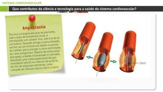 SISTEMA CARDIOVASCULAR
Que contributos da ciência e tecnologia para a saúde do sistema cardiovascular?
 