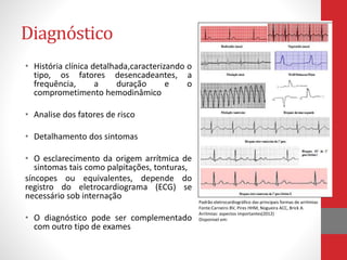 Diagnóstico 
• História clínica detalhada,caracterizando o 
tipo, os fatores desencadeantes, a 
frequência, a duração e o 
comprometimento hemodinâmico 
• Analise dos fatores de risco 
• Detalhamento dos sintomas 
• O esclarecimento da origem arrítmica de 
sintomas tais como palpitações, tonturas, 
síncopes ou equivalentes, depende do 
registro do eletrocardiograma (ECG) se 
necessário sob internação 
• O diagnóstico pode ser complementado 
com outro tipo de exames 
Padrão eletrocardiográfico das principais formas de arritmias 
Fonte:Carneiro BV, Pires HHM, Nogueira ACC, Brick A. 
Arritmias: aspectos importantes(2012) 
Disponivel em: 
 