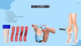 Inspección
Hay que valorar:
• Color de la piel.
• Aspecto de la piel
• Presencia de lesiones superficiales.
• Varicosidades.
• Placas cutáneas rojizas.
• Lesiones ulceradas. .
k
 