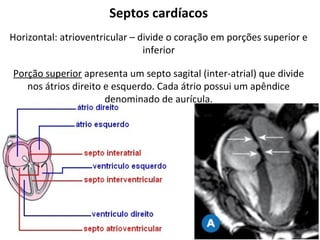 Septos cardíacos
Horizontal: atrioventricular – divide o coração em porções superior e
inferior
Porção superior apresenta um septo sagital (inter-atrial) que divide
nos átrios direito e esquerdo. Cada átrio possui um apêndice
denominado de aurícula.
 