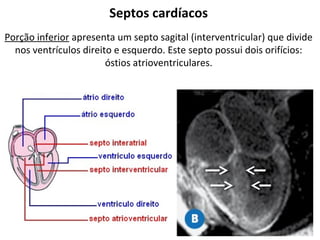 Septos cardíacos
Porção inferior apresenta um septo sagital (interventricular) que divide
nos ventrículos direito e esquerdo. Este septo possui dois orifícios:
óstios atrioventriculares.
 