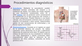 Sistema cardiovascular (5)