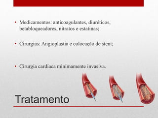 Tratamento
• Medicamentos: anticoagulantes, diuréticos,
betabloqueadores, nitratos e estatinas;
• Cirurgias: Angioplastia e colocação de stent;
• Cirurgia cardíaca minimamente invasiva.
 