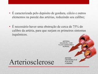 Arteriosclerose
• É caracterizada pelo depósito de gordura, cálcio e outros
elementos na parede das artérias, reduzindo seu calibre;
• É necessário haver uma obstrução de cerca de 75% do
calibre da artéria, para que surjam os primeiros sintomas
isquêmicos.
 