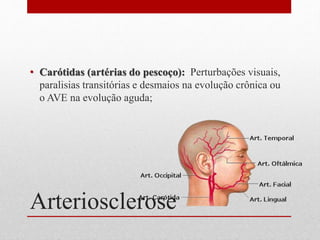 Arteriosclerose
• Carótidas (artérias do pescoço): Perturbações visuais,
paralisias transitórias e desmaios na evolução crônica ou
o AVE na evolução aguda;
 
