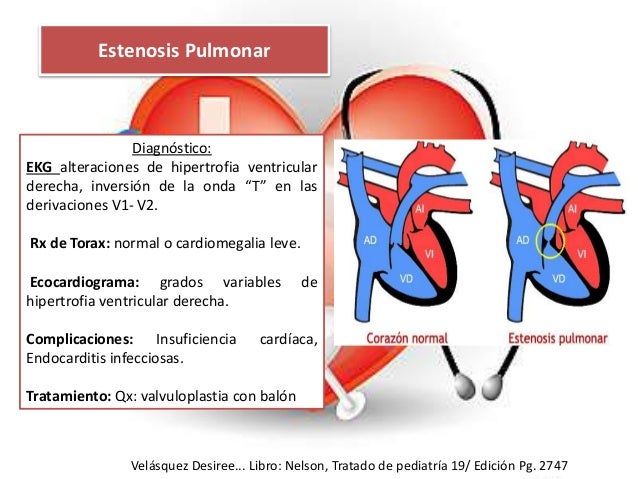 Sistema cardiovascular del corazon pediatria