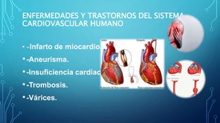 ENFERMEDADES Y TRASTORNOS DEL SISTEMA
CARDIOVASCULAR HUMANO
• -Infarto de miocardio.
•-Aneurisma.
•-Insuficiencia cardíaca.
•-Trombosis.
•-Várices.
 