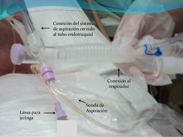 Sistema cerrado de aspiracion