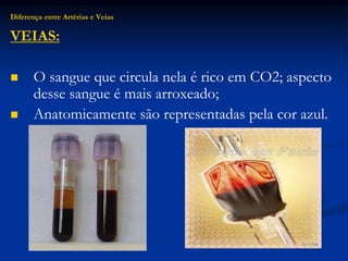 Diferença entre Artérias e Veias
VEIAS:
 O sangue que circula nela é rico em CO2; aspecto
desse sangue é mais arroxeado;
 Anatomicamente são representadas pela cor azul.
 