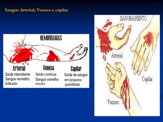 Sangue Arterial; Venoso e capilar
 