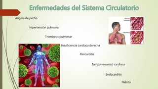 Angina de pecho
Hipertensión pulmonar
Trombosis pulmonar
Insuficiencia cardíaca derecha
Pericarditis
Tamponamiento cardíaco
Endocarditis
Flebitis
 