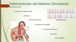 Insuficiencia mitral
Prolapso de la válvula mitral
Estenosis
Insuficiencia aórtica
Insuficiencia tricuspídea
Insuficiencia pulmonar
Miocarditis
Miocardiopatía
Fribrilación Auricular
 