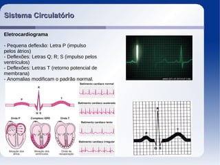 Sistema CirculatórioSistema Circulatório
Eletrocardiograma
- Pequena deflexão: Letra P (impulso
pelos átrios)
- Deflexões: Letras Q; R; S (impulso pelos
ventrículos)
- Deflexões: Letras T (retorno potencial de
membrana)
- Anomalias modificam o padrão normal.
 