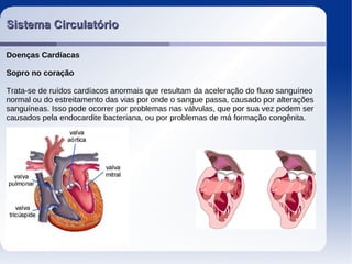 Sistema CirculatórioSistema Circulatório
Doenças Cardíacas
Sopro no coração
Trata-se de ruídos cardíacos anormais que resultam da aceleração do fluxo sanguíneo
normal ou do estreitamento das vias por onde o sangue passa, causado por alterações
sanguíneas. Isso pode ocorrer por problemas nas válvulas, que por sua vez podem ser
causados pela endocardite bacteriana, ou por problemas de má formação congênita.
 