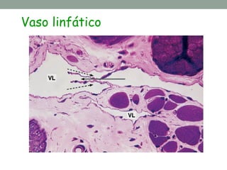 Vaso linfático
 