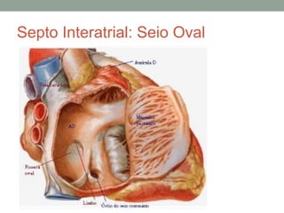 Septo Interatrial: Seio Oval
 