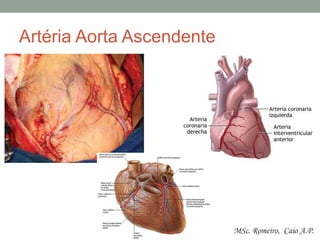 Artéria Aorta Ascendente
MSc. Romeiro, Caio A.P.
 