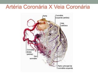 Artéria Coronária X Veia Coronária
 