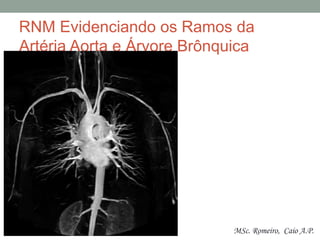 RNM Evidenciando os Ramos da
Artéria Aorta e Árvore Brônquica
MSc. Romeiro, Caio A.P.
 