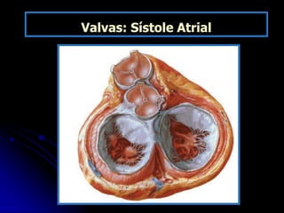 Valvas: Sístole Atrial
 