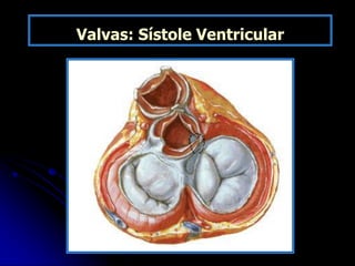 Valvas: Sístole Ventricular
 