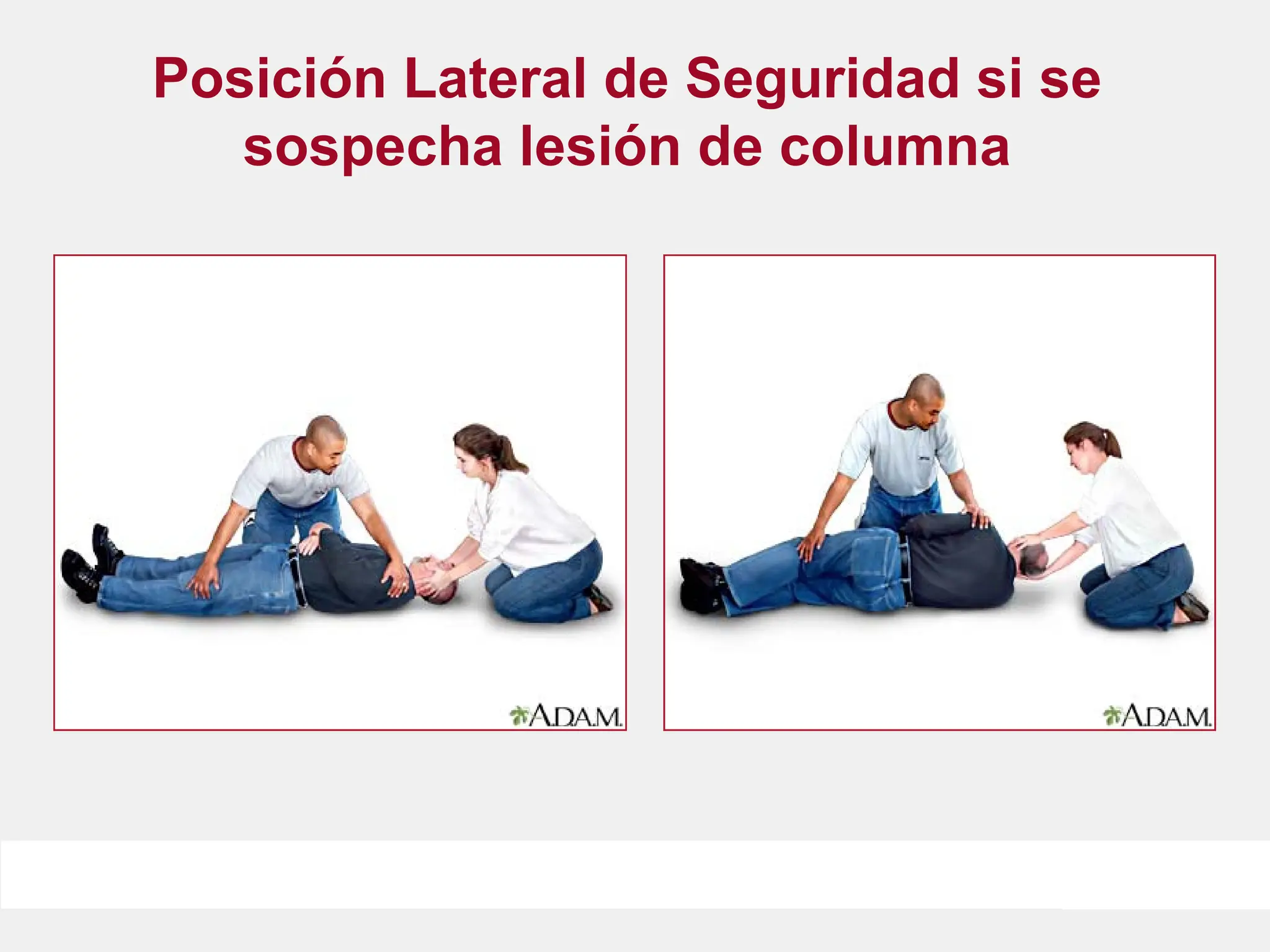 Posición Lateral de Seguridad si se
sospecha lesión de columna
 