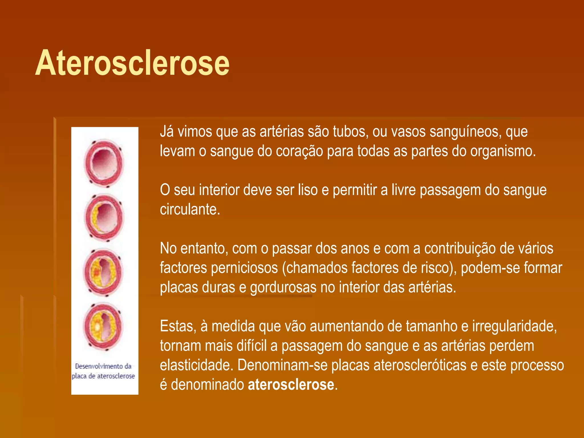 Aterosclerose
Já vimos que as artérias são tubos, ou vasos sanguíneos, que
levam o sangue do coração para todas as partes do organismo.
O seu interior deve ser liso e permitir a livre passagem do sangue
circulante.
No entanto, com o passar dos anos e com a contribuição de vários
factores perniciosos (chamados factores de risco), podem-se formar
placas duras e gordurosas no interior das artérias.
Estas, à medida que vão aumentando de tamanho e irregularidade,
tornam mais difícil a passagem do sangue e as artérias perdem
elasticidade. Denominam-se placas ateroscleróticas e este processo
é denominado aterosclerose.
 