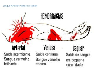 Sangue Arterial; Venoso e capilar
 