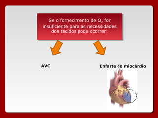 Se o fornecimento de O22 for
    Se o fornecimento de O for
insuficiente para as necessidades
 insuficiente para as necessidades
    dos tecidos pode ocorrer:
     dos tecidos pode ocorrer:




AVC                      Enfarte do miocárdio
 