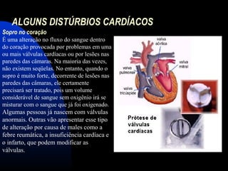 ALGUNS DISTÚRBIOS CARDÍACOS
Sopro no coração
É uma alteração no fluxo do sangue dentro
do coração provocada por problemas em uma
ou mais válvulas cardíacas ou por lesões nas
paredes das câmaras. Na maioria das vezes,
não existem seqüelas. No entanto, quando o
sopro é muito forte, decorrente de lesões nas
paredes das câmaras, ele certamente
precisará ser tratado, pois um volume
considerável de sangue sem oxigênio irá se
misturar com o sangue que já foi oxigenado.
Algumas pessoas já nascem com válvulas
anormais. Outras vão apresentar esse tipo
de alteração por causa de males como a
febre reumática, a insuficiência cardíaca e
o infarto, que podem modificar as
válvulas.
 